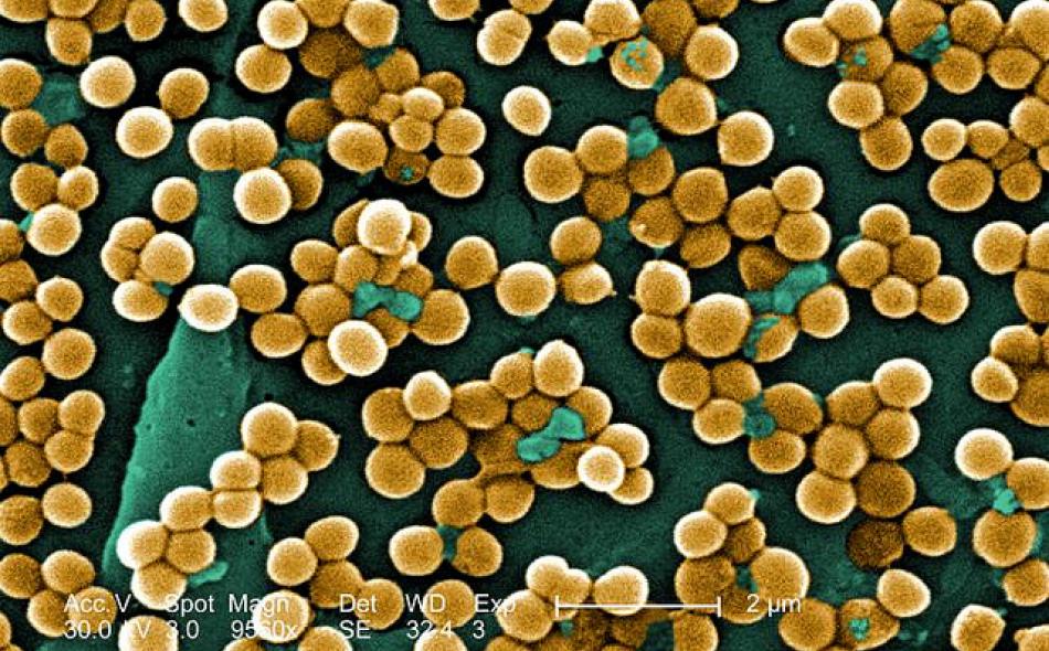Obama administration lags on farm drivers of antibiotic resistance