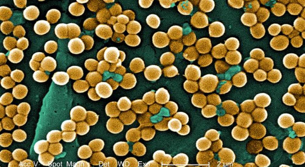Obama administration lags on farm drivers of antibiotic resistance